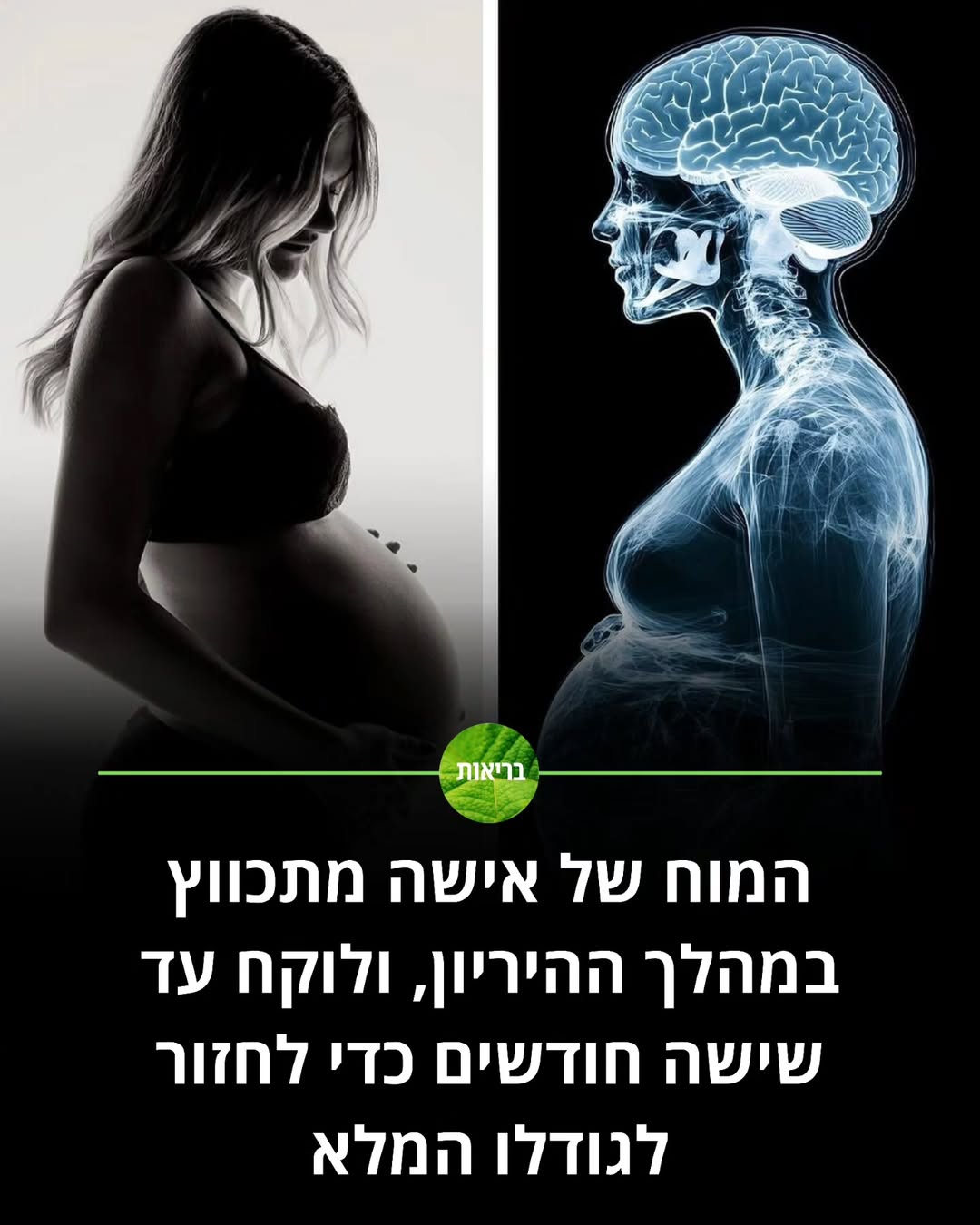 תמונה 1 מתוך 1