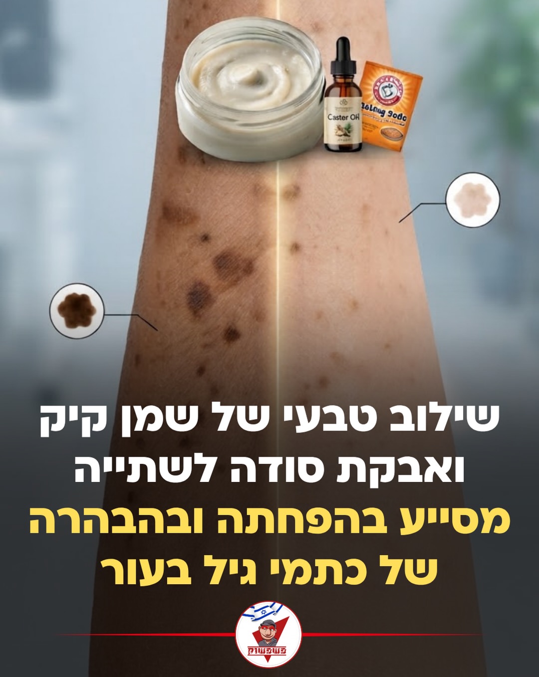 תמונה 3 מתוך 8