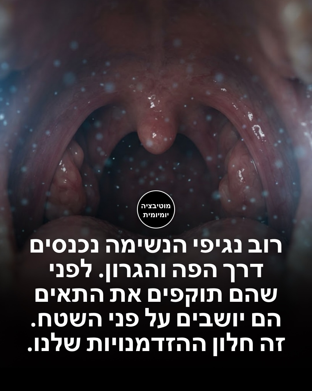תמונה 4 מתוך 13